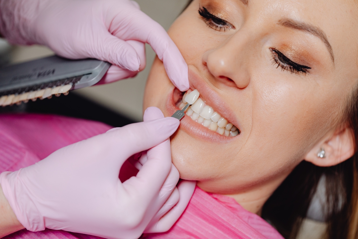Porcelain veneers Ocoee