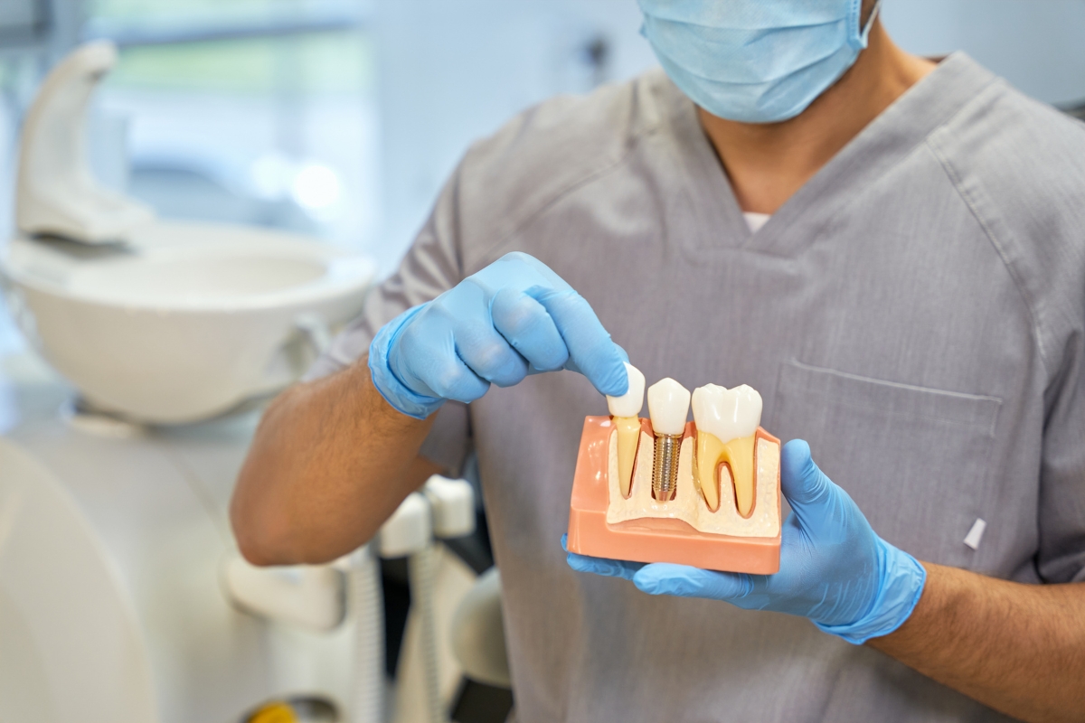 dental implants in Orlando