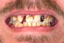Before