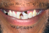 Before