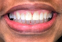 After