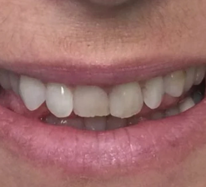 Before