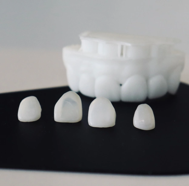 Porcelain Veneers in MetroWest, Orlando