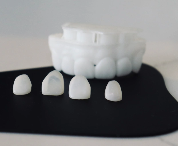 Porcelain Veneers in Sand Lake, Orlando