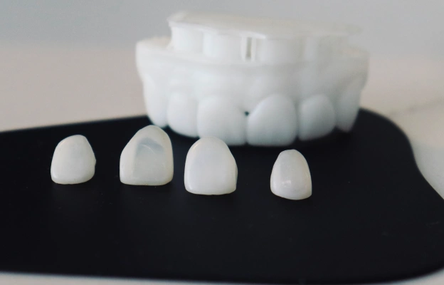 Porcelain Veneers in Orlando, FL